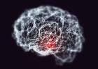 PELEARLE AL ALZHEIMER