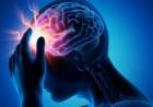 Por qué están aumentando los accidentes cerebrovasculares en el mundo