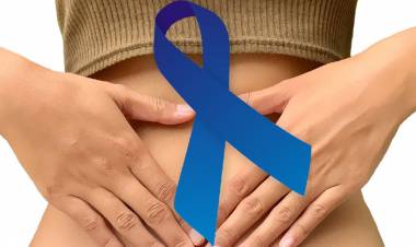 Cáncer de Colon. Las cosas por su nombre